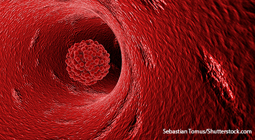 blood clot illustration